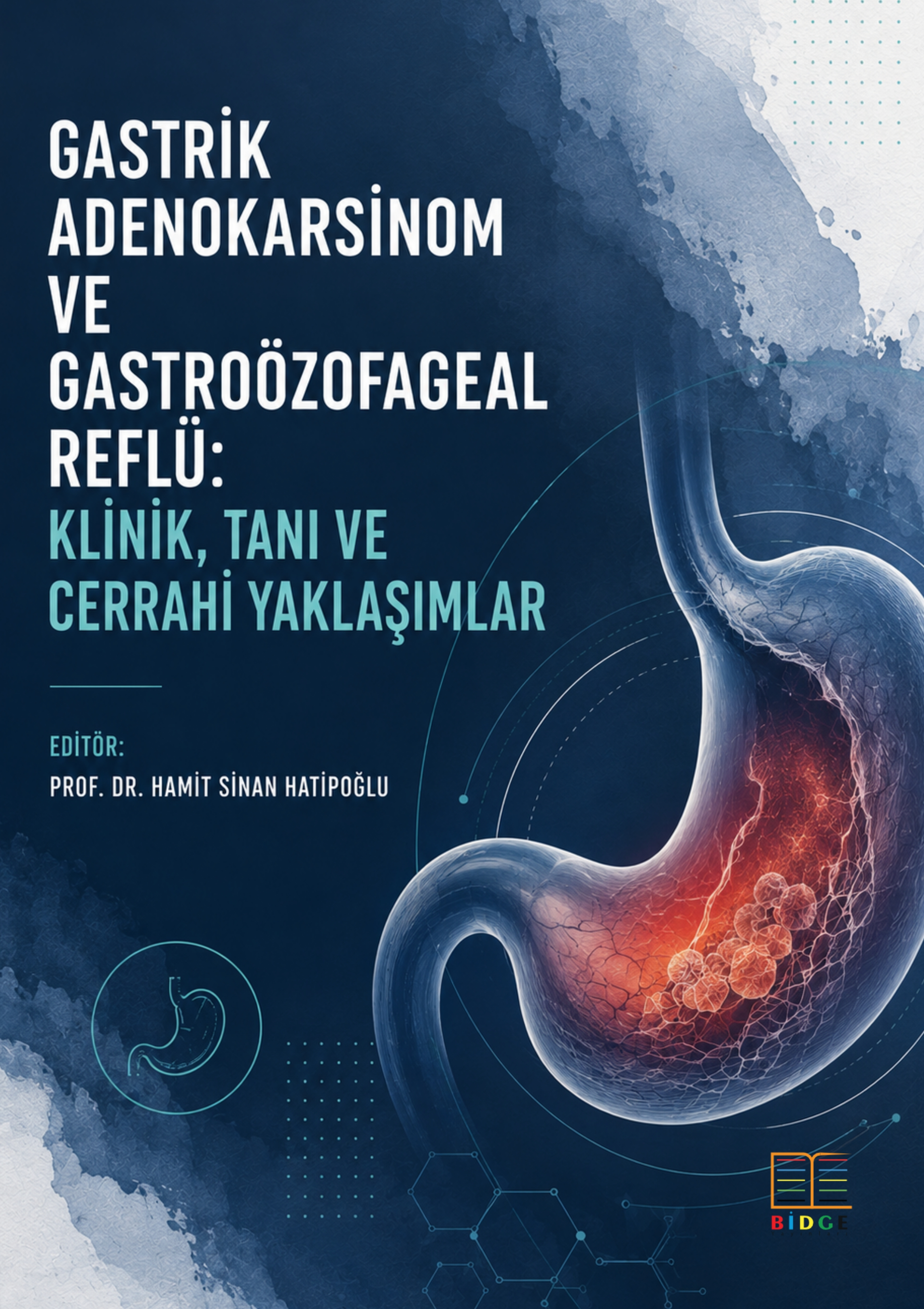 Gastrik Adenokarsinom ve Gastroözofageal Reflü: Klinik, Cerrahi Ve Moleküler Yaklaşımlar kapak görseli