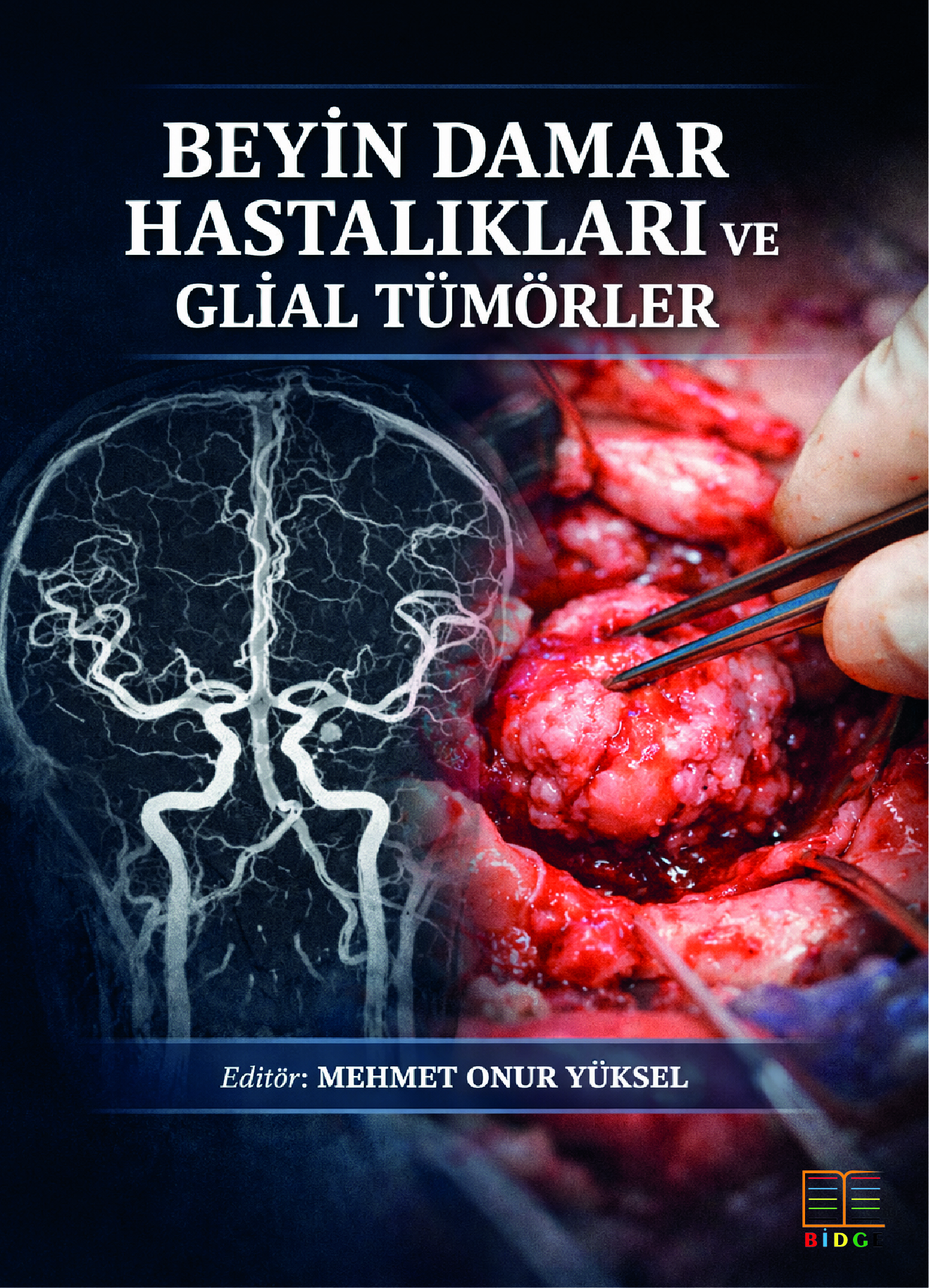 Beyin Damar Hastalıkları ve Glial Tümörler kapak görseli