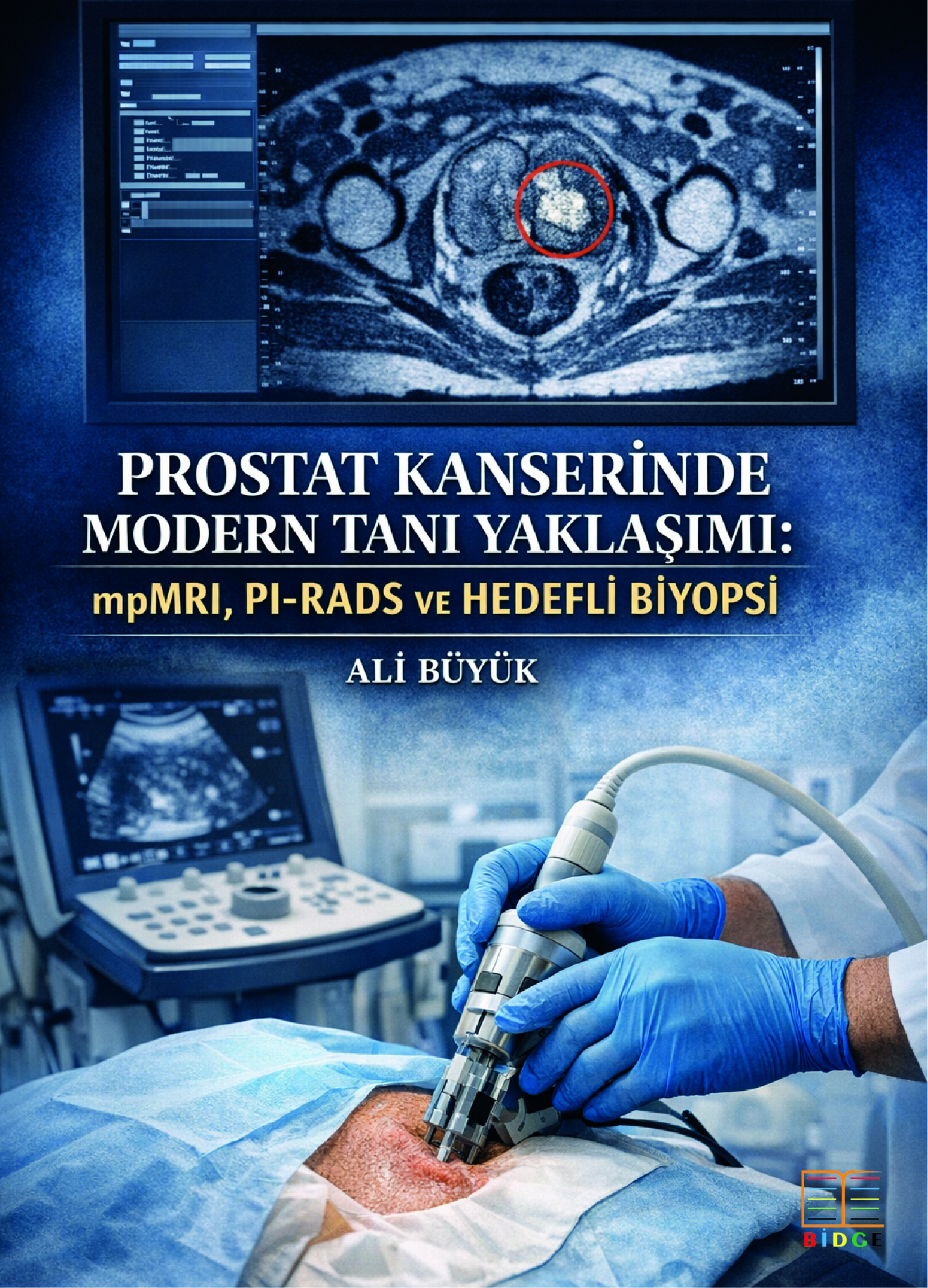 Prostat Kanserinde Modern Tanı Yaklaşımı: mpMRI, PI-RADS ve Hedefli Biyopsi kapak görseli